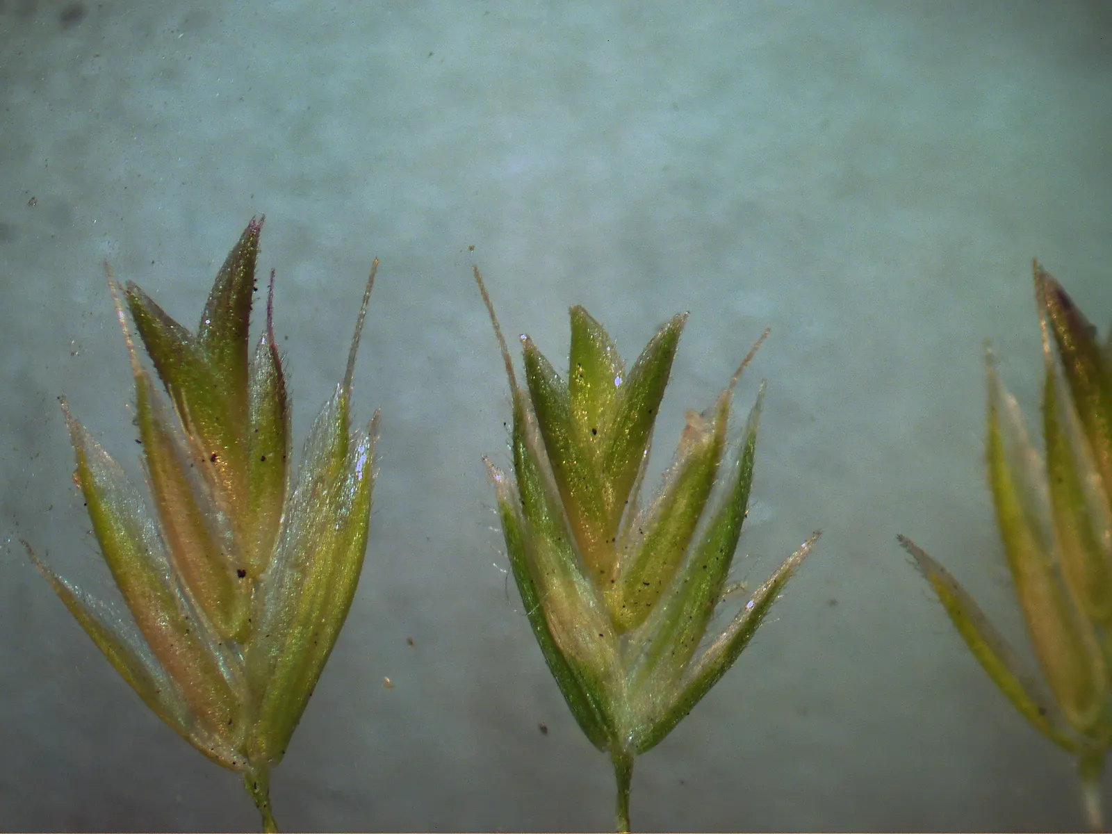 Blue Fescue, Blue Fescue Grass (Festuca Glauca) — Blue Fescue (Festuca glauca) is a resilient ornamental grass